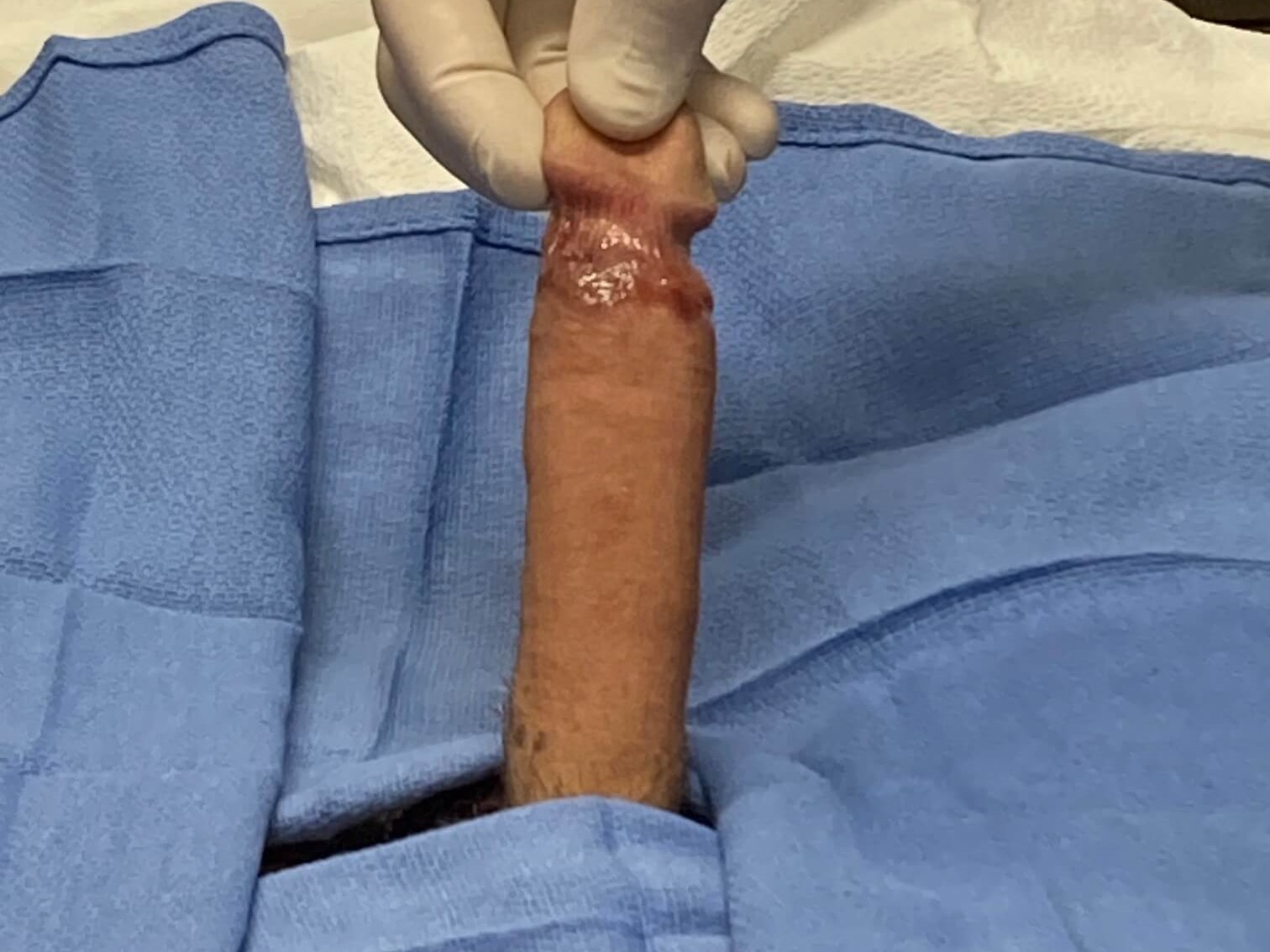 After Image