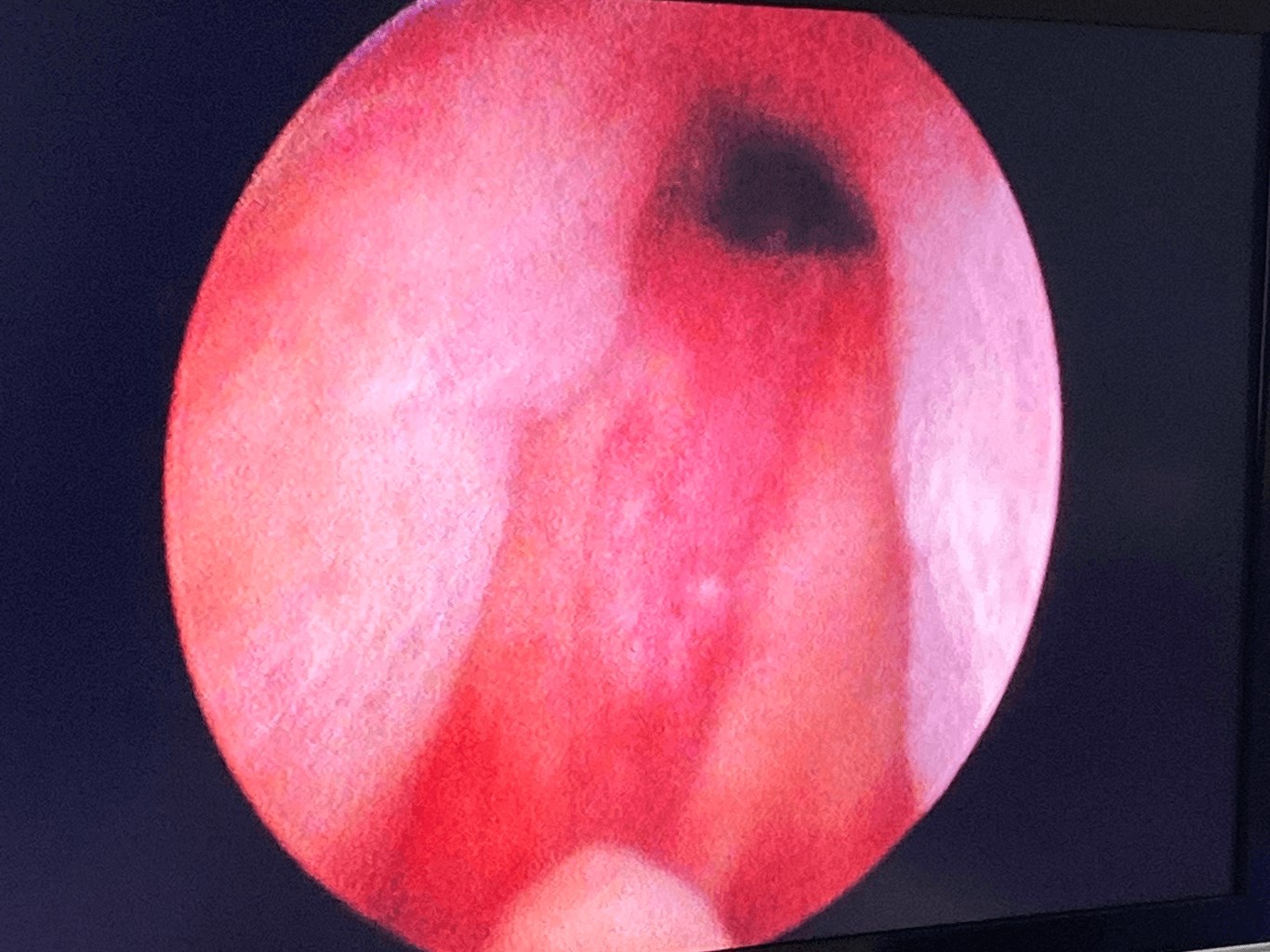After Image