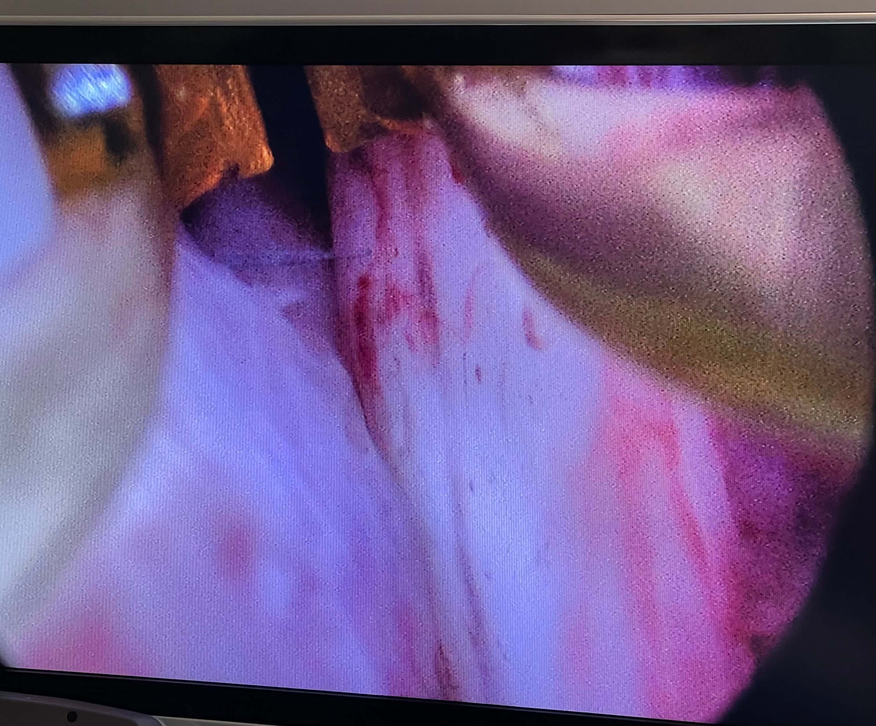 Before Image
