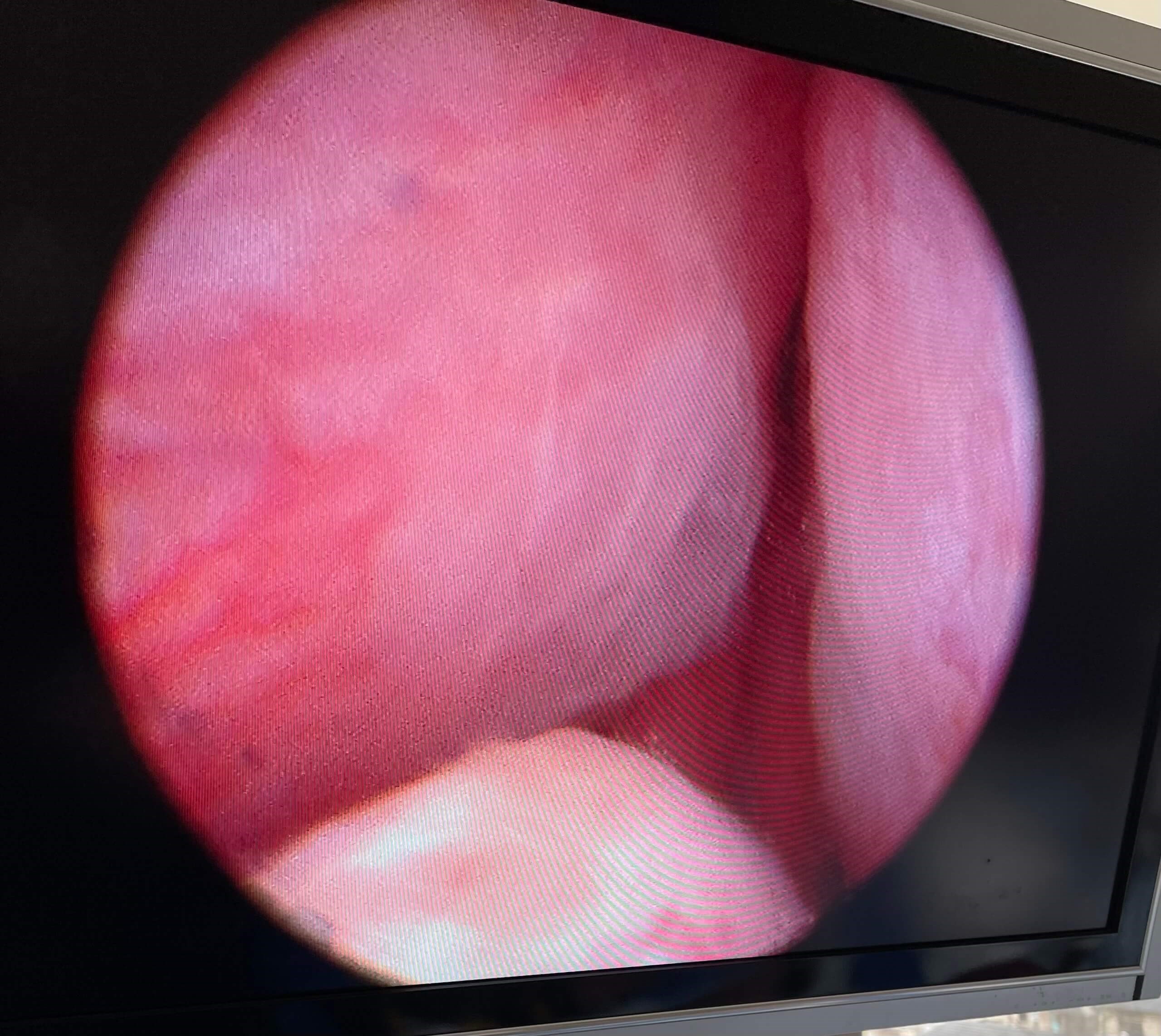 Before Image
