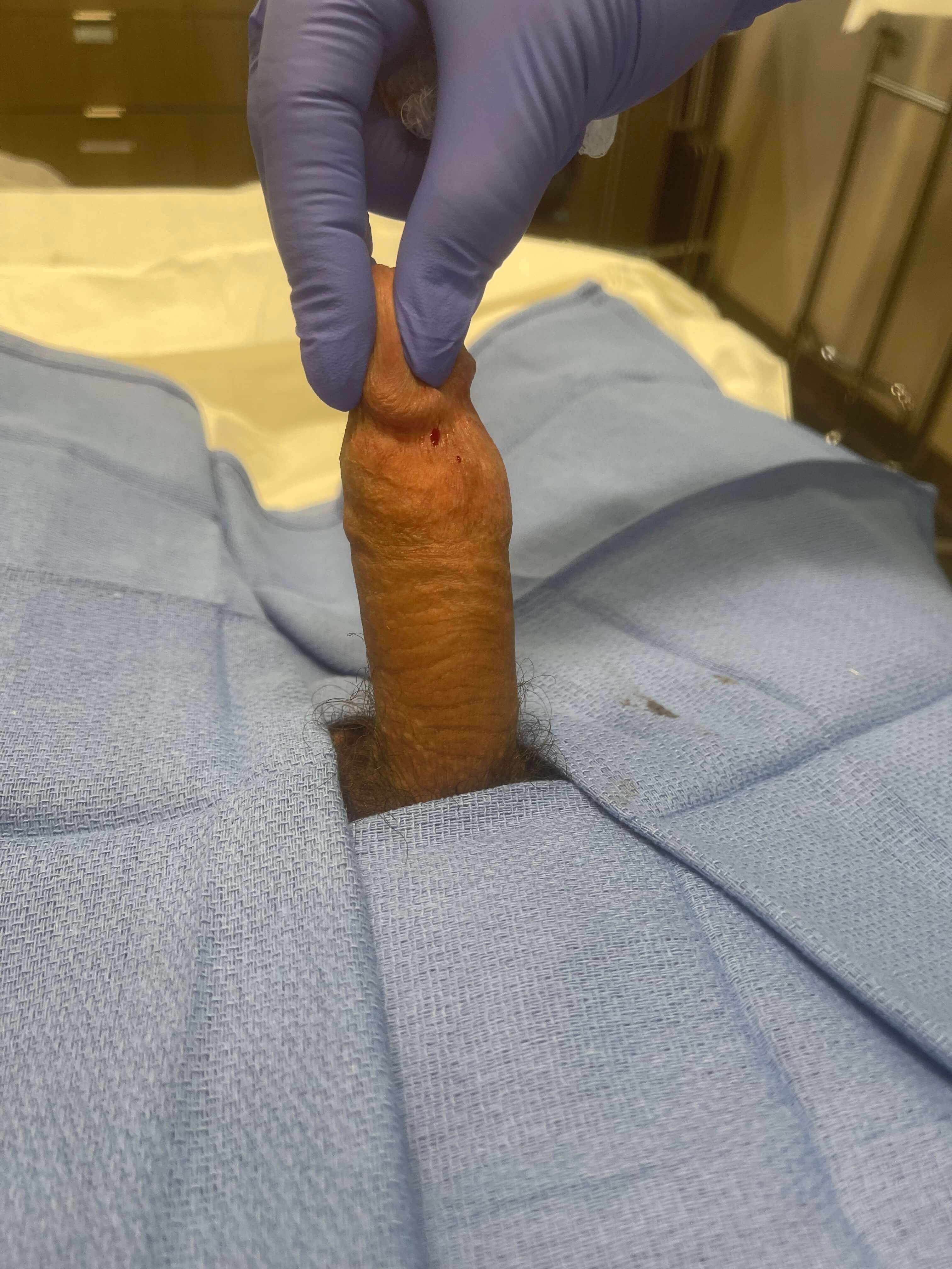 After Image