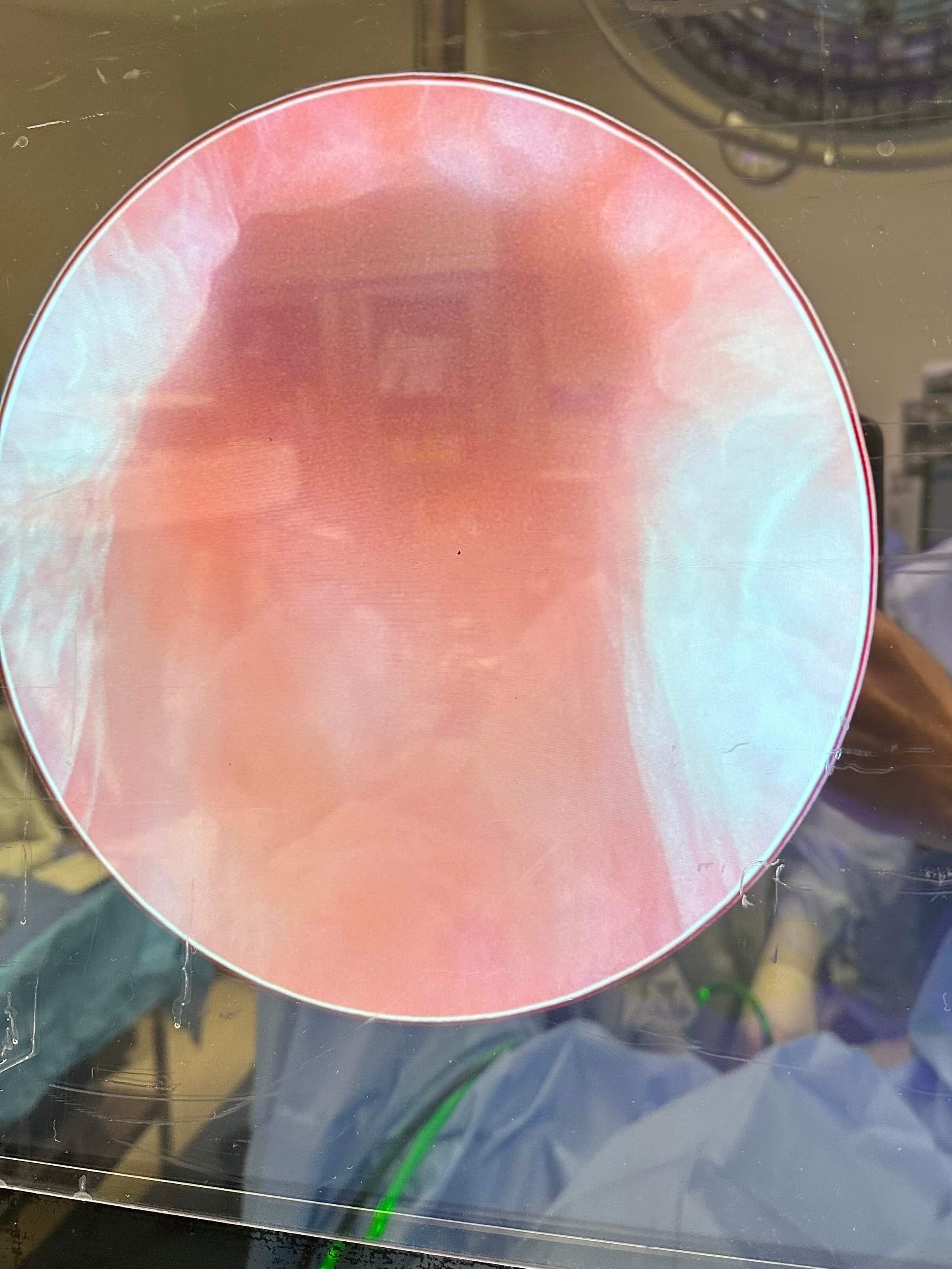 Urolift with 39g prostate 