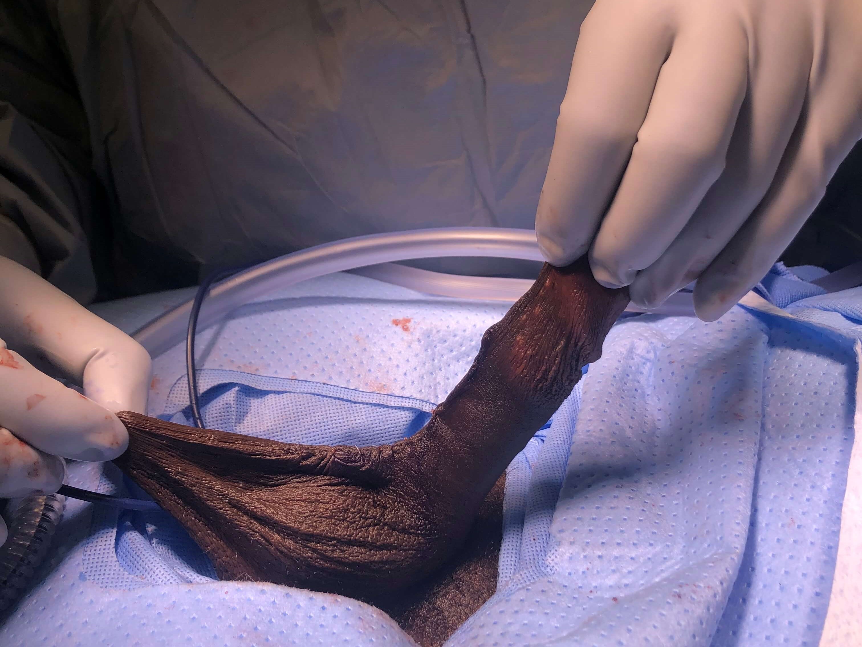 Before & After - Scrotum Lift Before