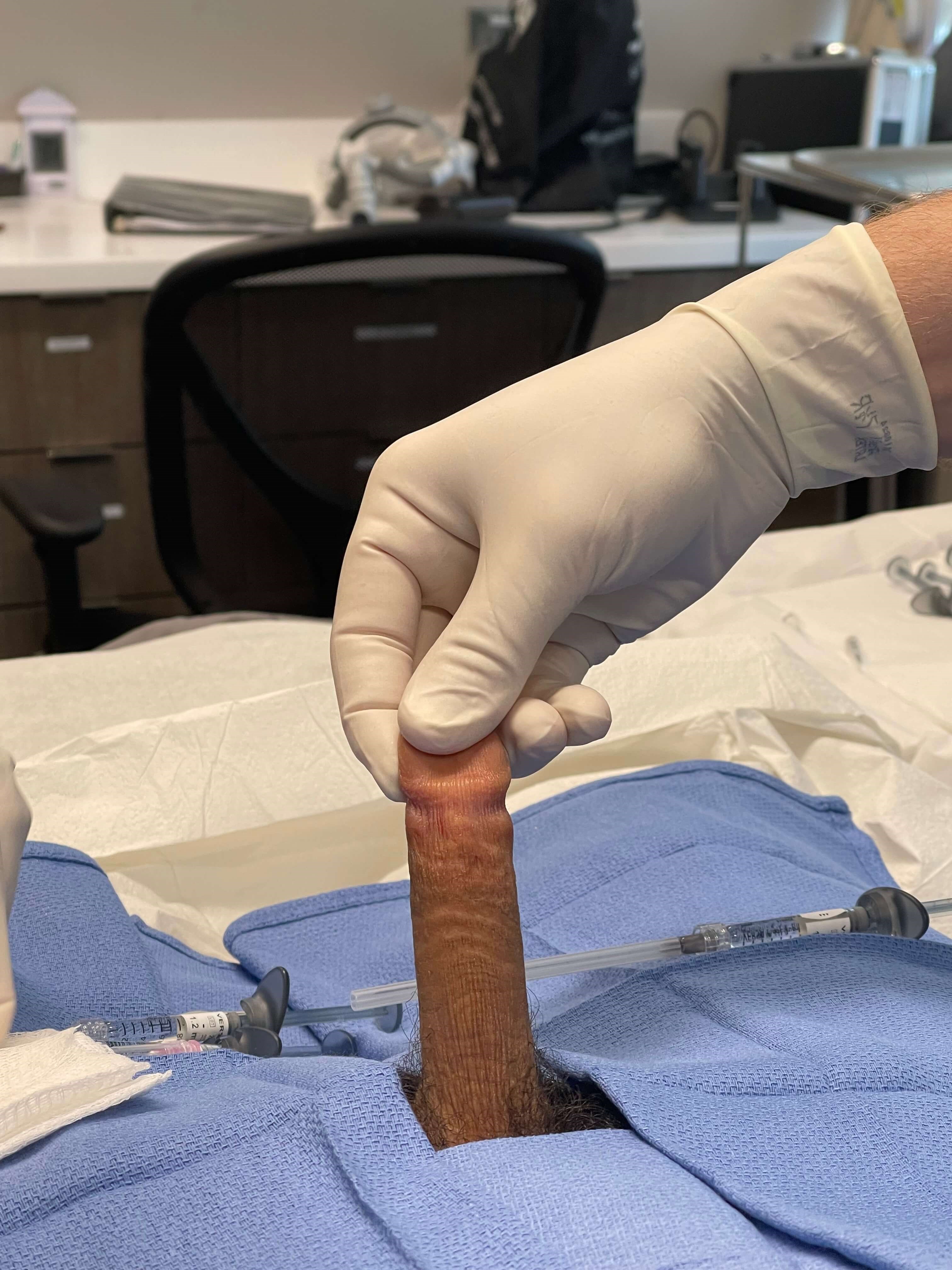 12 mls of Urofill Before